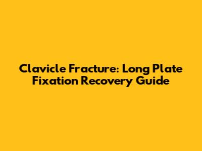 Clavicle Fracture: Long Plate Fixation Recovery Guide