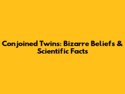 Conjoined Twins: Bizarre Beliefs & Scientific Facts