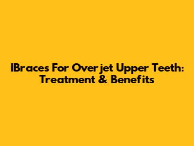 IBraces For Overjet Upper Teeth: Treatment & Benefits