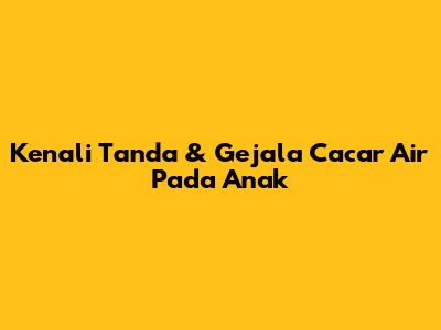 Kenali Tanda & Gejala Cacar Air Pada Anak