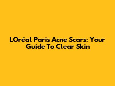 L'Oréal Paris Acne Scars: Your Guide To Clear Skin