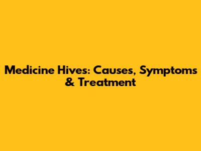 Medicine Hives: Causes, Symptoms & Treatment