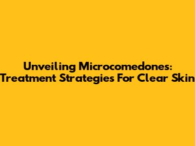 Unveiling Microcomedones: Treatment Strategies For Clear Skin